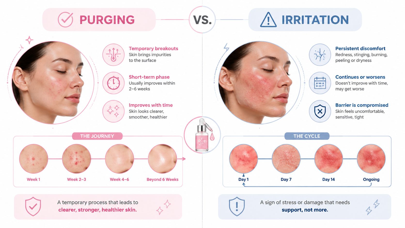 A comparison infographic between skin purging and skin irritation, showing differences in symptoms, duration, and outcomes.