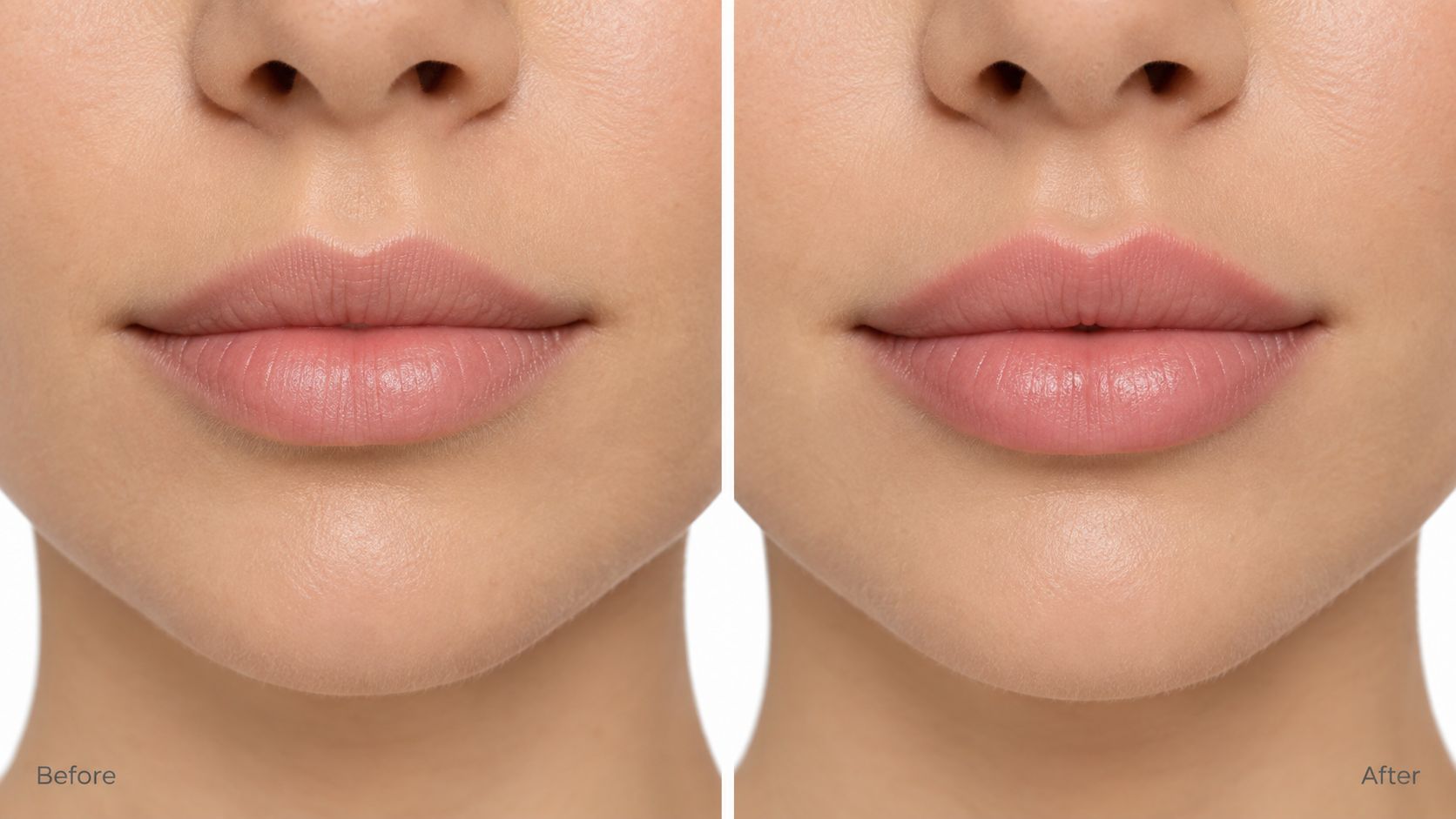 A close-up comparison of a person's lips showing the natural results of a lip liner application.